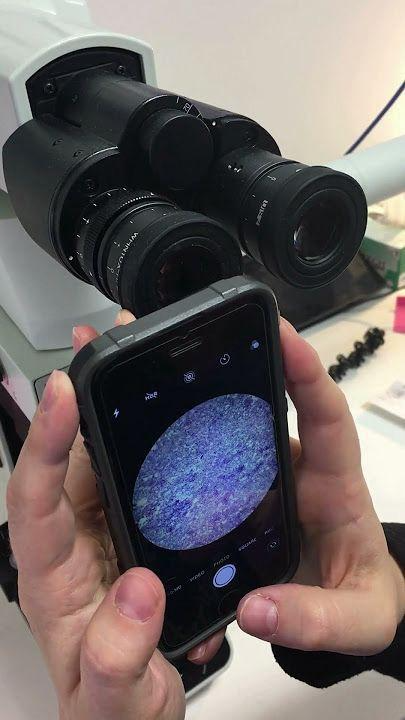 Microscopic smear imaging on smartphone